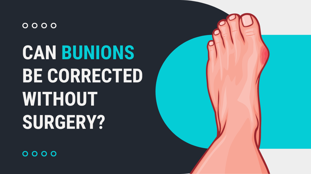 Can Bunions Be Corrected Without Surgery?